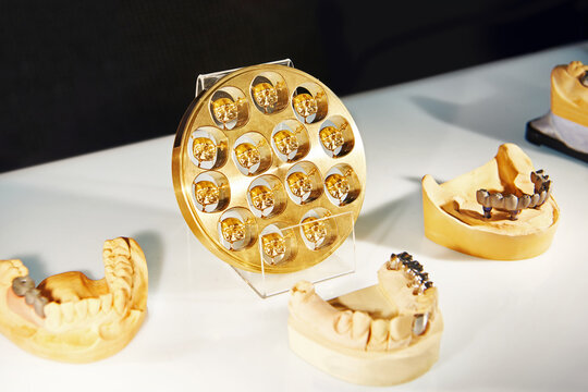 Dental crown placement equipment