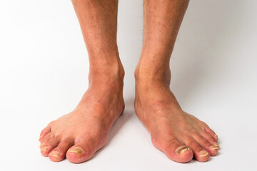 Human feet with white background