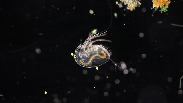 Bacteria,Protozoa and Green Algae in waste water under the microscope.
