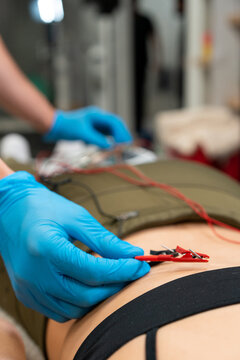 Crop unrecognizable physical therapist in sterile gloves inserting needle electrode into back skin of woman in hospital