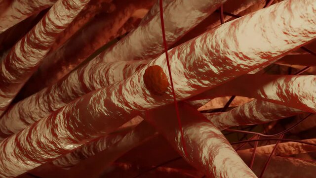 osteoclaste, medically accurate, Bone modeling and remodeling, Bone tissue, Calcium absorbing cells from bone and cartilage, 3d render