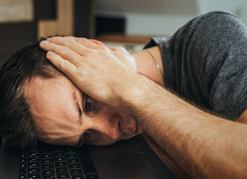 Young Man Lies Stressed In Home Office With Head On Laptop And Has Burnout Due To High Workload At Workplace - Emotional Stress