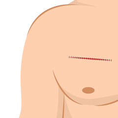 Suture on body. Sewing on body cartoon vector. free space for text. copy space.