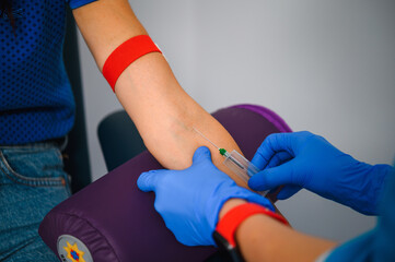 Blood sampling from a vein for research
