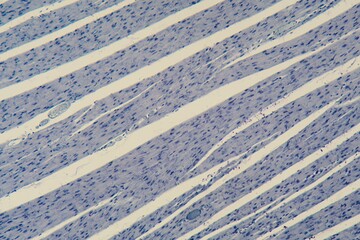 Human cardiac muscle under the microscope