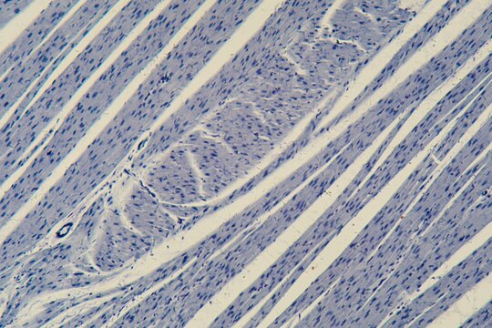 Human cardiac muscle under the microscope