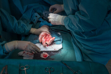 doctor performs a hand surgery operation