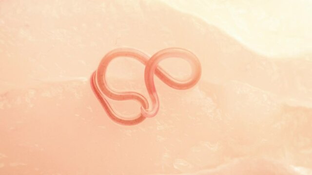 Fish worm on fish filet parasitic&nbsp;nematode macro