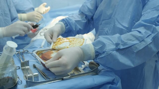 The surgeon prepares a sterile silicone breast implant for breast augmentation surgery