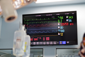 The screen showed monitoring vital sign during open heart surgery.