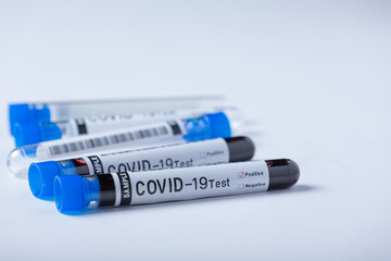 Fototapeta premium Test tube with blood sample for COVID-19 test