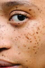 Close up portrait of girl with freckles - obrazy, fototapety, plakaty
