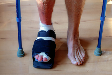Foot surgery, Plaster or pressure bandage wrapped feet after operation, Right side feet with a...