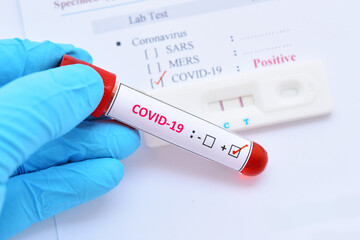 Obraz premium COVID-19 positive test result by using rapid card test 