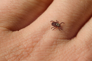 The tick crawls along the hand. Carrier of dangerous diseases