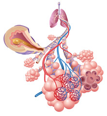 Illustration showing the inflamation of the bronchus causing asthma