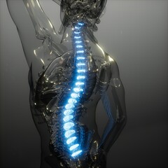 Backache in Back Bones