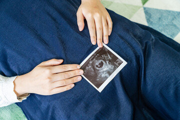 赤ちゃんのエコー写真を持った妊婦の写真。妊娠中のイメージ。