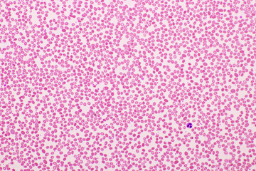 Red blood cells in blood smear, Wright-Giemsa stain, analyze by microscope, 400x