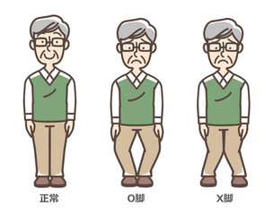 変形性膝関節症　おじいさん