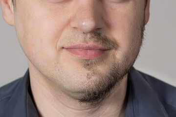 Obraz premium A Caucasian male with a half-shaved beard. Choosing to wear a beard or not