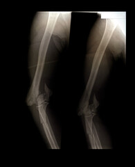 Head x-ray film images used to diagnose neurological and tumor diseases for diagnosis.