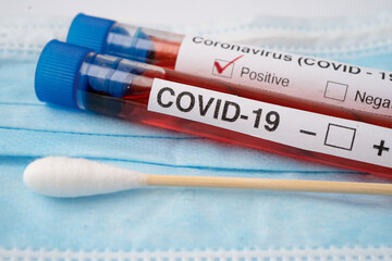 COVID-19 virus or Coronavirus sample blood test tube in laboratory of hospital.