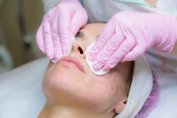 A young woman is wiped off traces of blood from a plasma injection on her face. Plasmolifting....