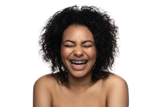 Happy smiling black woman with a dental braces on her teeth