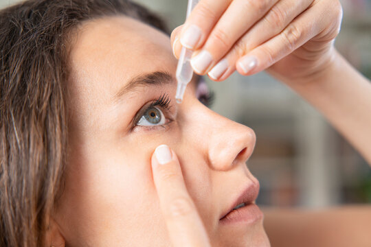 Closeup view of young woman applying eye drop, artificial tears..