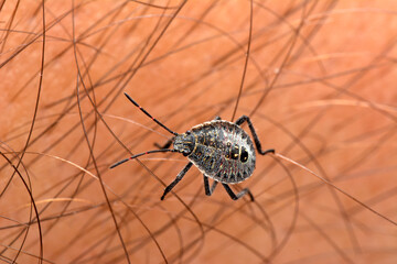 Sucking tick Macro photo on human skin. Ixodes ricinus. Bloated parasite bitten into pink irritated epidermis. Small red drops. Dangerous insect mite. Encephalitis, Lyme disease infection.    