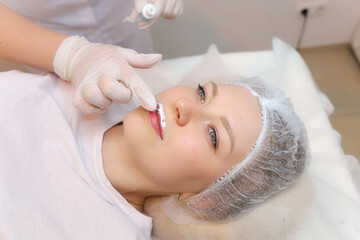 The cosmetologist applies anesthesia prepares the client's lips for the procedure of injection of hyaluronic acid