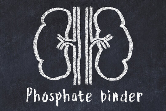 Chalk Drawing Of Human Kidneys And Medical Term Phosphate Binder. Concept Of Learning Medicine