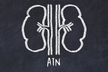 Chalk drawing of human kidneys and medical term ATN. Concept of learning medicine