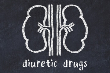Chalk drawing of human kidneys and medical term diuretic drugs. Concept of learning medicine