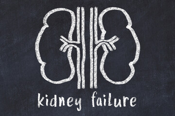 Chalk drawing of human kidneys and medical term kidney failure. Concept of learning medicine
