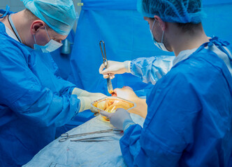 Breast augmentation under the guidance surgeons team in surgical operating room.