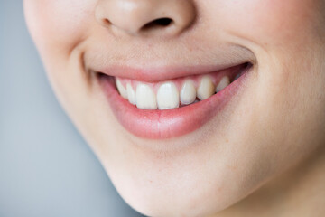 Close up portrait of Young Asian girl teeth smiling