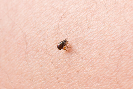 Flea  on human skin. Destruction of parasites in pets