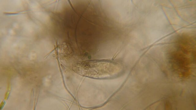 Bacteria Parasites and Worms in drinking Water under Microscope. nematode Worm under Microscope, Parasites Among Roundworms: Roundworms, Pinworms, Trichinella. Environmental Pollution.