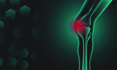 Illustration of Arthritis knee joint . Rheumatoid arthritis. Pain in leg. Human bone anatomy flat vector illustration. Painful injury erosion on a green-black background.