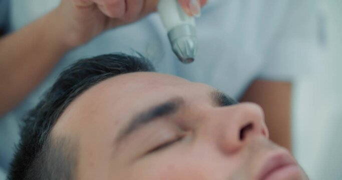 Close-up face a male client who is having a non-injection mesotherapy procedure on his forehead by using Dermadrop TDA device.