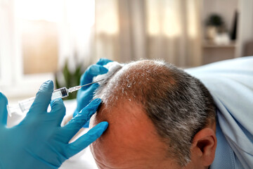 Man with hair loss problem receiving injection in head by young female doctor. Treatment of baldness with beauty injection. Man with hair loss problem receiving injection on white background, close up