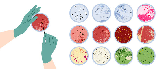 Scientist's hand in glove holding Petri dish, plate with agar, bacterial colony. Bacteriology. Microbiology. Laboratory test, bacteriological swab, chemical analysis. Vector flat cartoon illustration - 435532706