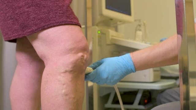 phlebologist or vascular surgeon examines the varicose veins of the lower extremities of a patient in a modern dermatological clinic.