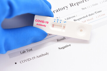 Negative test result of COVID-19 virus by using rapid card test antibody method