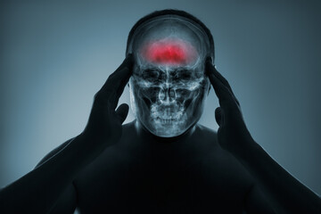 X-ray of a man's head. Medical examination of head injuries. Frontal part of the brain is highlighted by red colour.