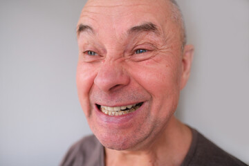 face of a European old man close-up, wrinkles on the aging skin, bares his teeth, makes grimaces, opening his mouth, the concept of mental health, cosmetology, age-related changes