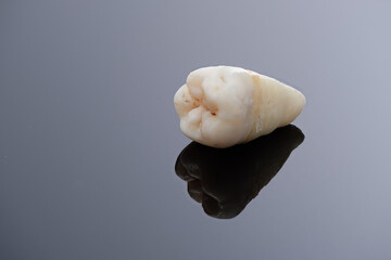 Pulled wisdom tooth on black