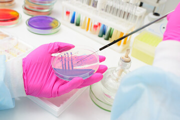 A researcher fills a Petri dish with a layer of nutrient medium and cultivates colonies of...